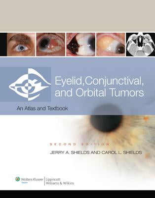 Eyelid Tumors, Second Edition